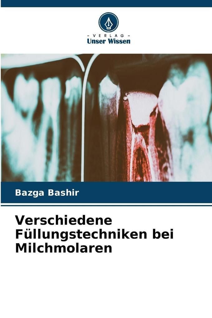 Verschiedene Füllungstechniken bei Milchmolaren