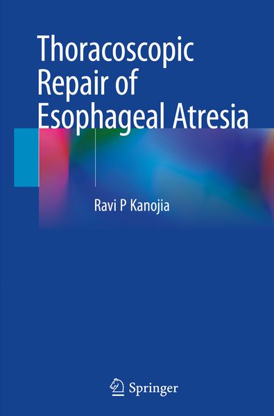 Thoracoscopic Repair of Esophageal Atresia