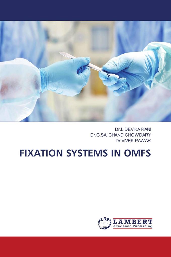 FIXATION SYSTEMS IN OMFS