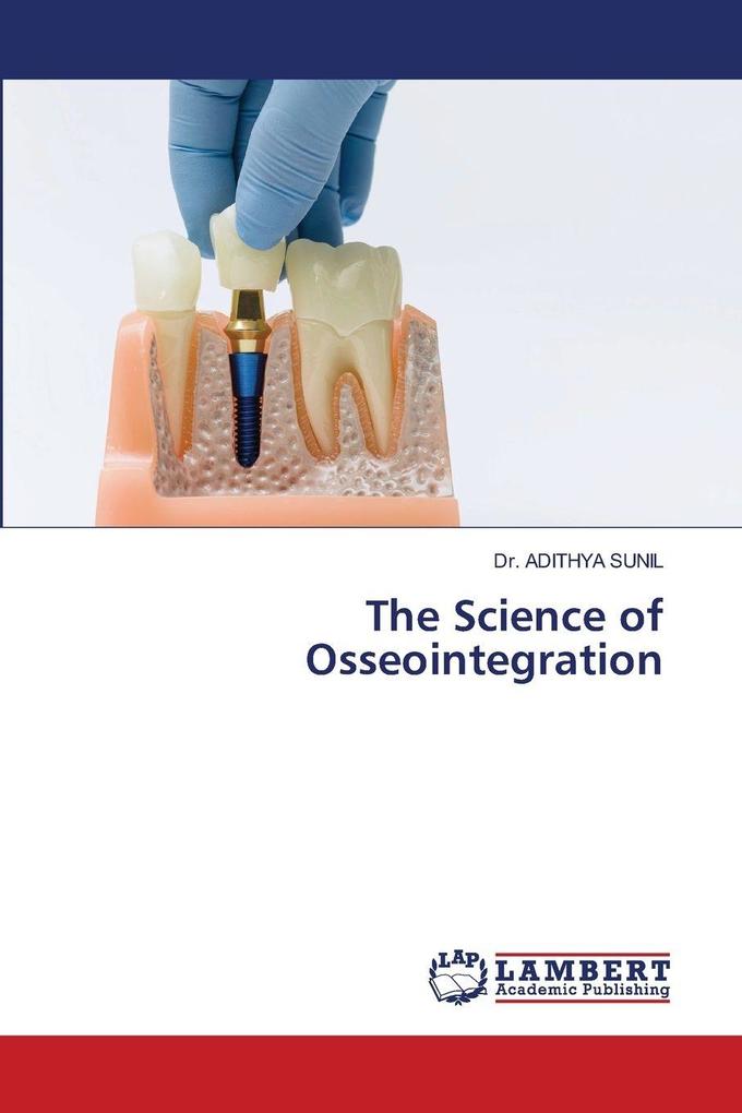 The Science of Osseointegration