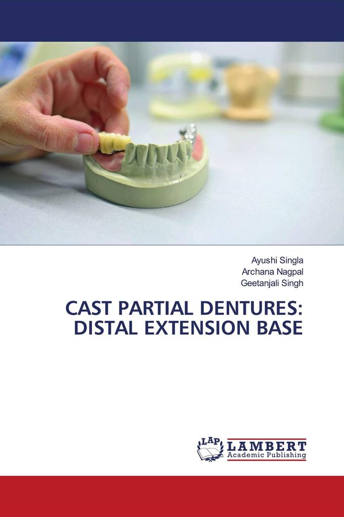 CAST PARTIAL DENTURES: DISTAL EXTENSION BASE