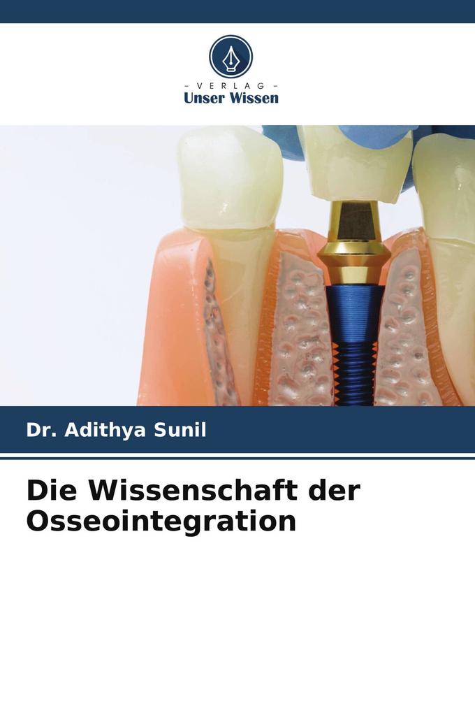 Die Wissenschaft der Osseointegration