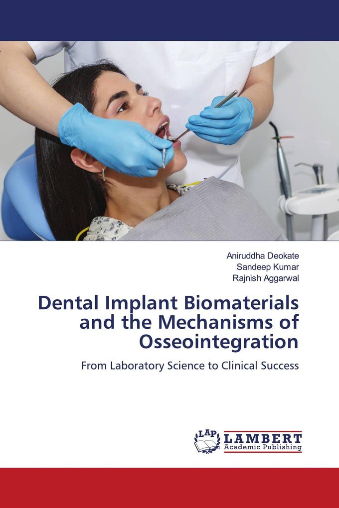 Dental Implant Biomaterials and the Mechanisms of Osseointegration