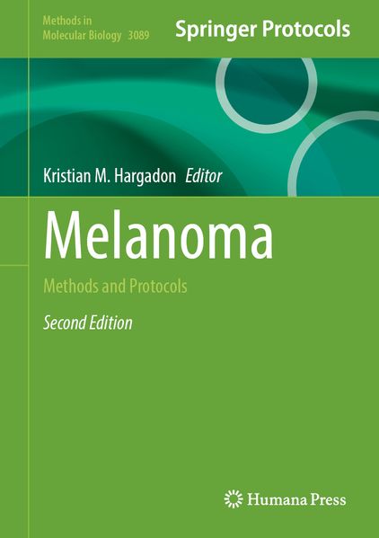 Melanoma