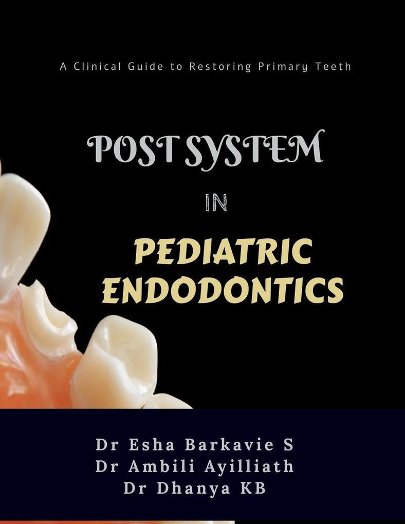 POST SYSTEM IN PEDIATRIC ENDODONTICS