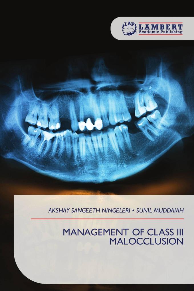 MANAGEMENT OF CLASS III MALOCCLUSION