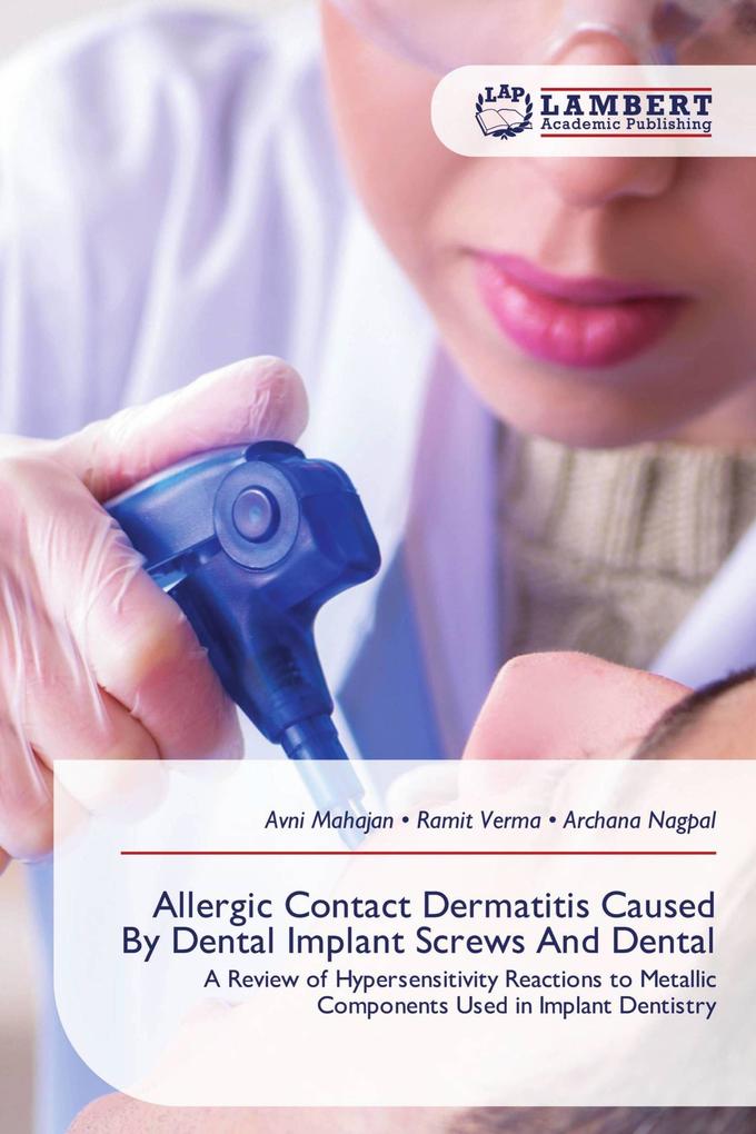 Allergic Contact Dermatitis Caused By Dental Implant Screws And Dental