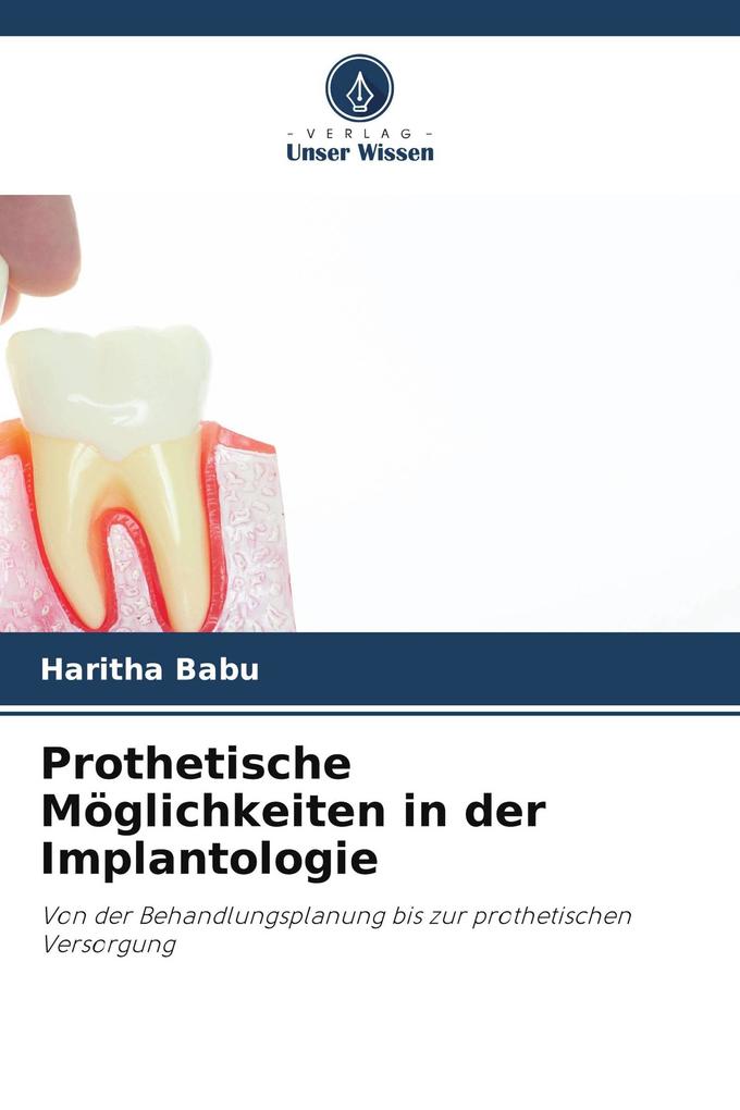 Prothetische Möglichkeiten in der Implantologie