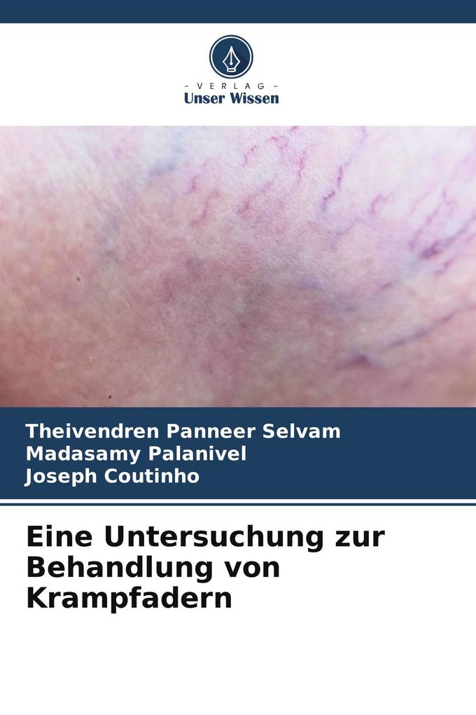 Eine Untersuchung zur Behandlung von Krampfadern