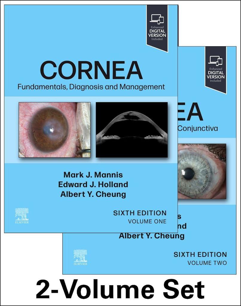 Cornea 2-Volume Set