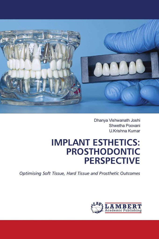IMPLANT ESTHETICS: PROSTHODONTIC PERSPECTIVE