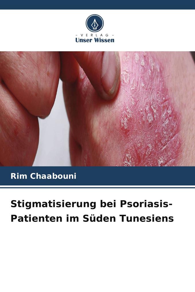 Stigmatisierung bei Psoriasis-Patienten im Süden Tunesiens