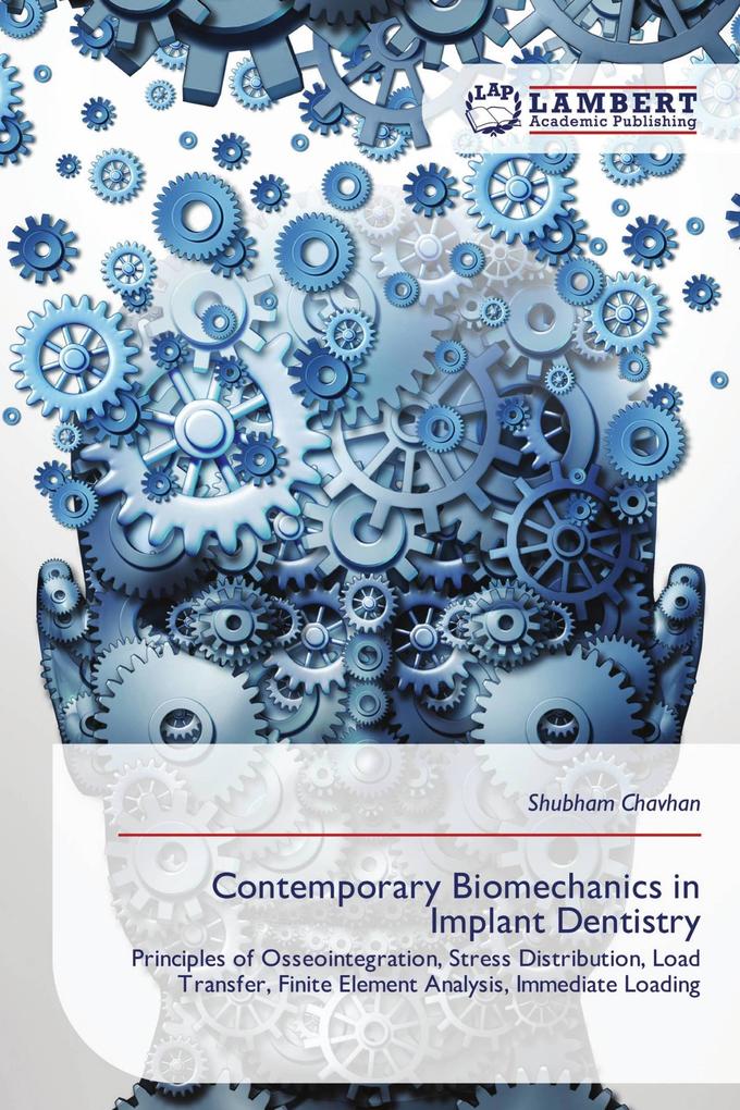 Contemporary Biomechanics in Implant Dentistry