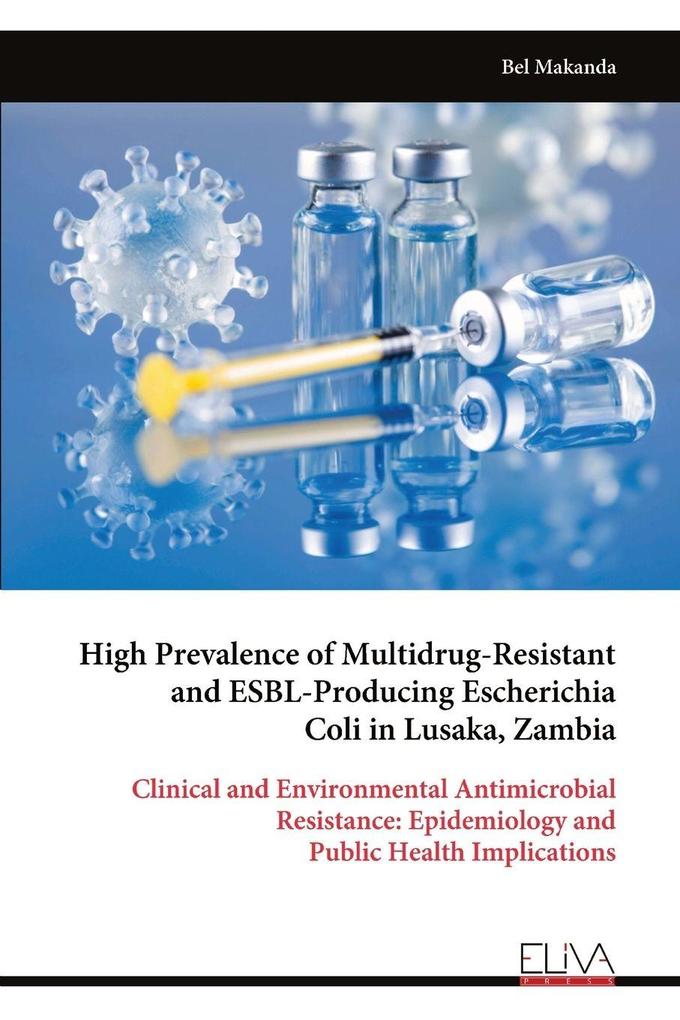 High Prevalence of Multidrug-Resistant and ESBL-Producing Escherichia Coli in Lusaka Zambia