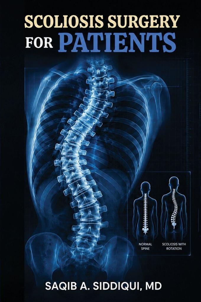 Scoliosis Surgery for Patients