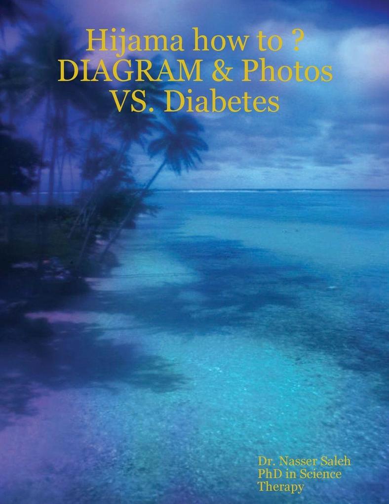 Hijama how to ? DIAGRAM & Photos VS. Diabetes