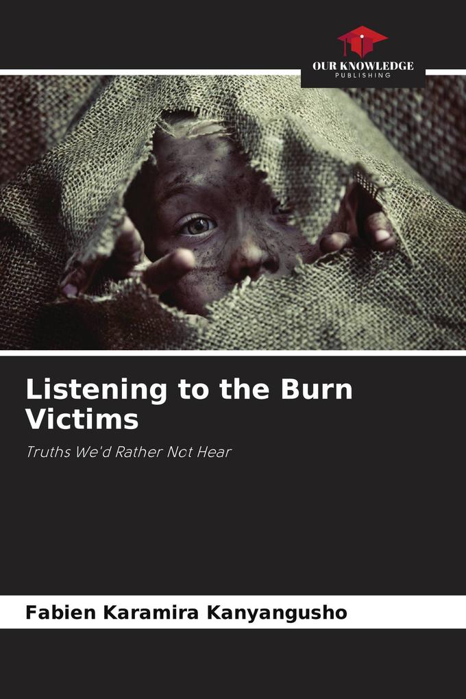 Listening to the Burn Victims