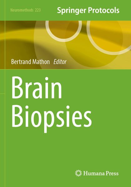 Brain Biopsies