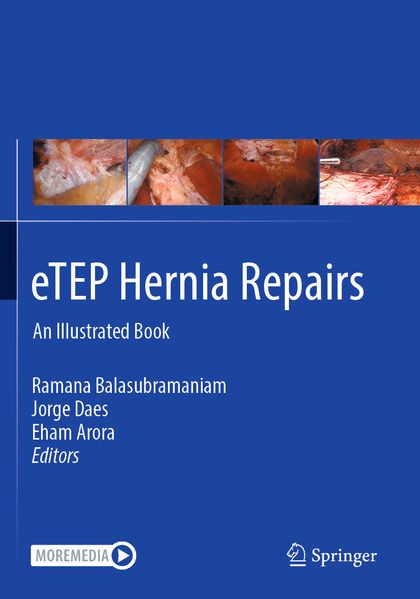 eTEP Hernia Repairs
