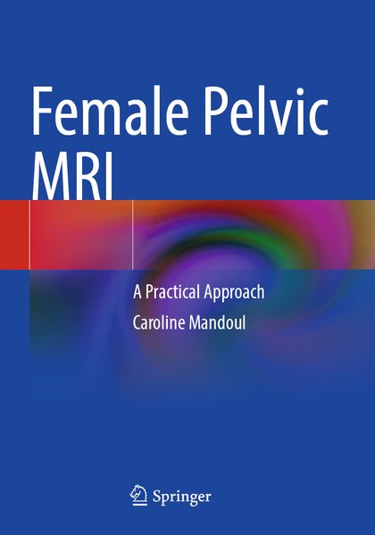 Female Pelvic MRI