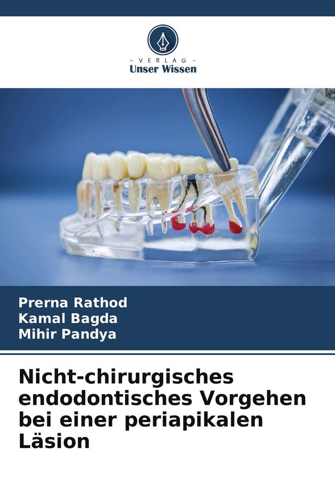 Nicht-chirurgisches endodontisches Vorgehen bei einer periapikalen Läsion