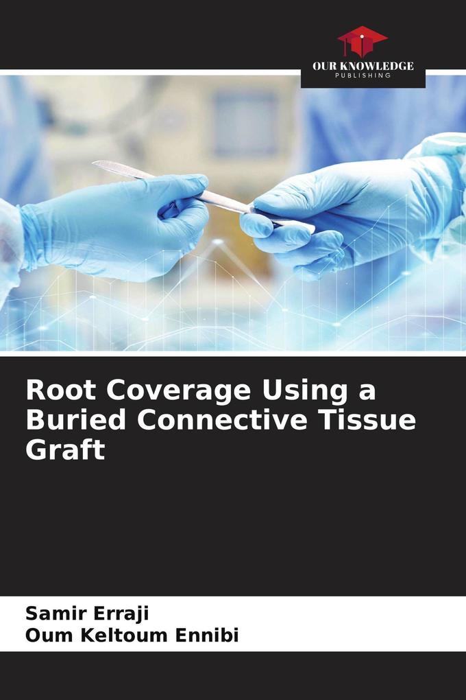 Root Coverage Using a Buried Connective Tissue Graft