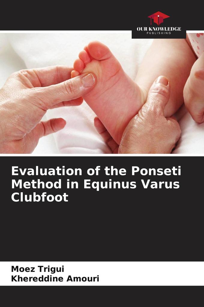 Evaluation of the Ponseti Method in Equinus Varus Clubfoot