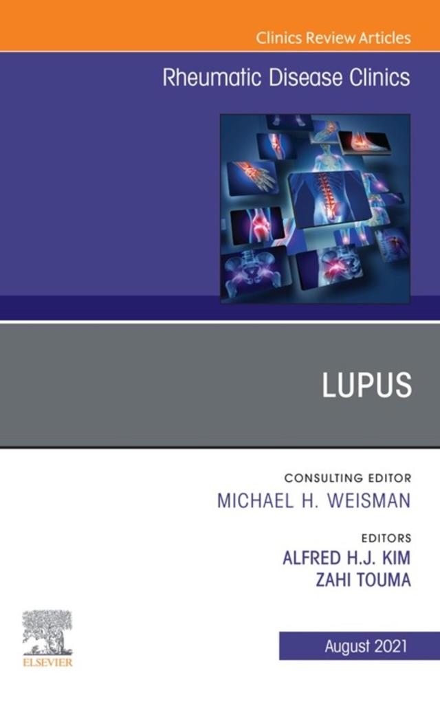 Lupus An Issue of Rheumatic Disease Clinics of North America E-Book