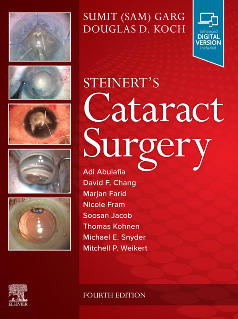 Cataract Surgery