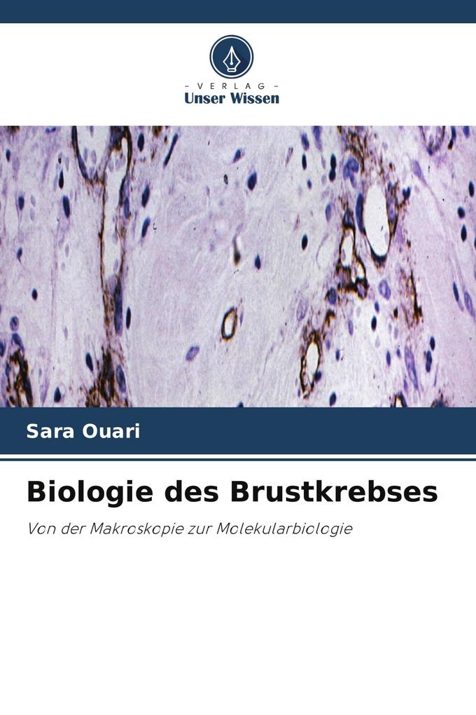 Biologie des Brustkrebses