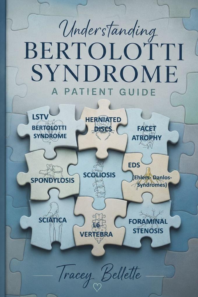 Understanding Bertolotti Syndrome