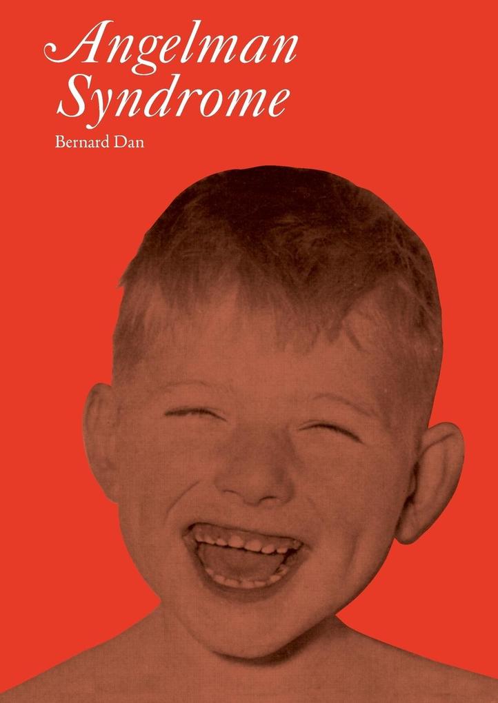 Angelman Syndrome