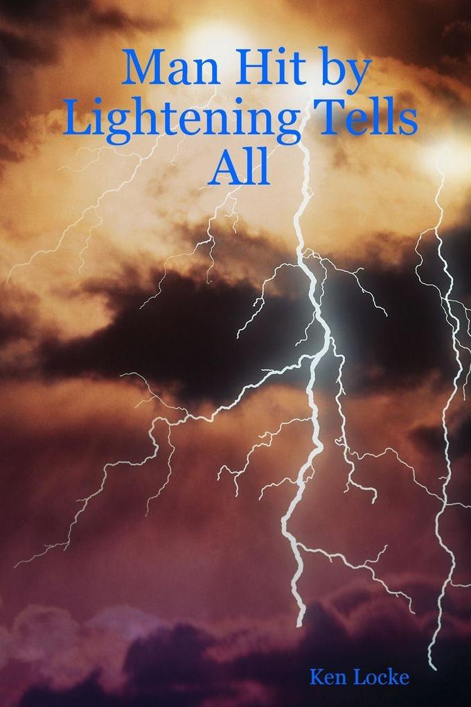 Man Hit by Lightening Tells All