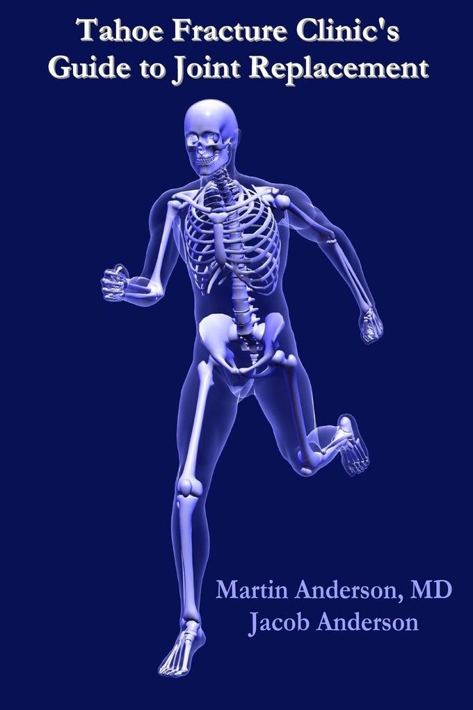Tahoe Fracture Clinic's Guide to Joint Replacement