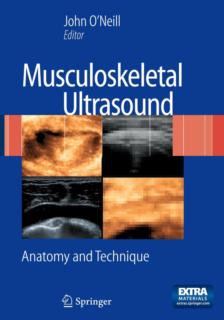 Musculoskeletal Ultrasound