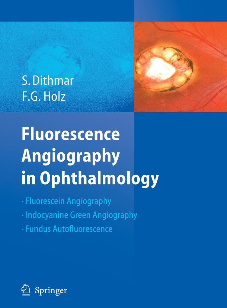 Fluorescence Angiography in Ophthalmology - Stefan Dithmar/ Frank G. Holz