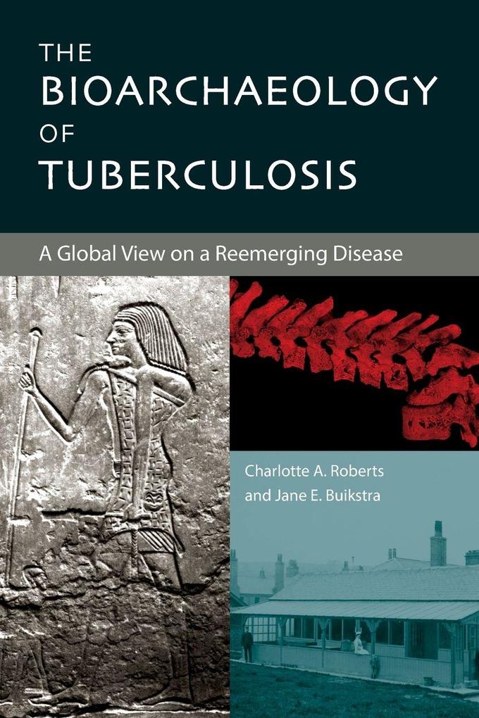 The Bioarchaeology of Tuberculosis