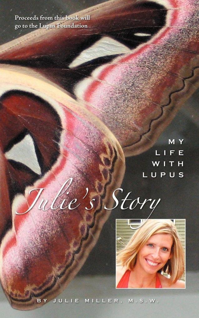 Julie's Story My Life With Lupus