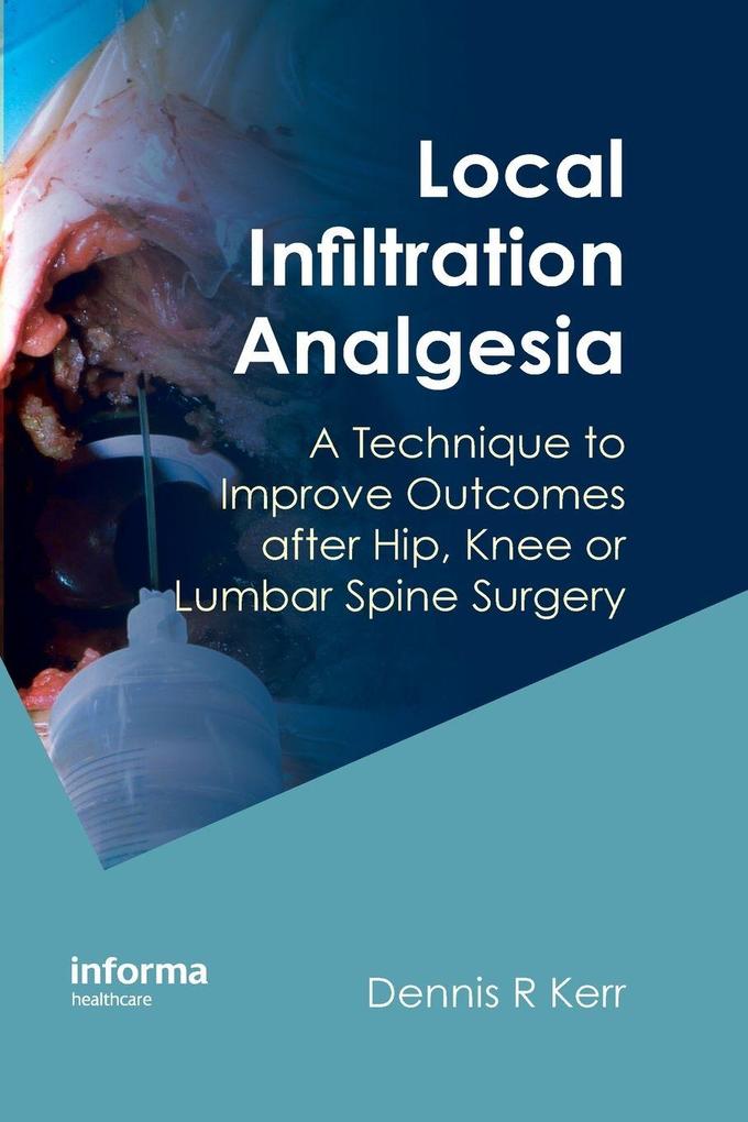 Local Infiltration Analgesia