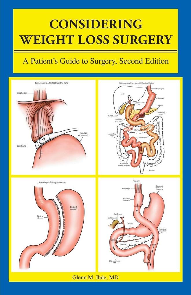 Considering Weight Loss Surgery
