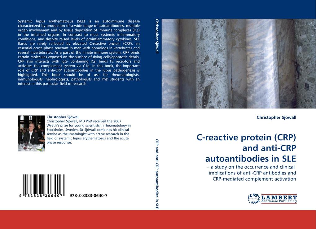 C-reactive protein (CRP) and anti-CRP autoantibodies in SLE