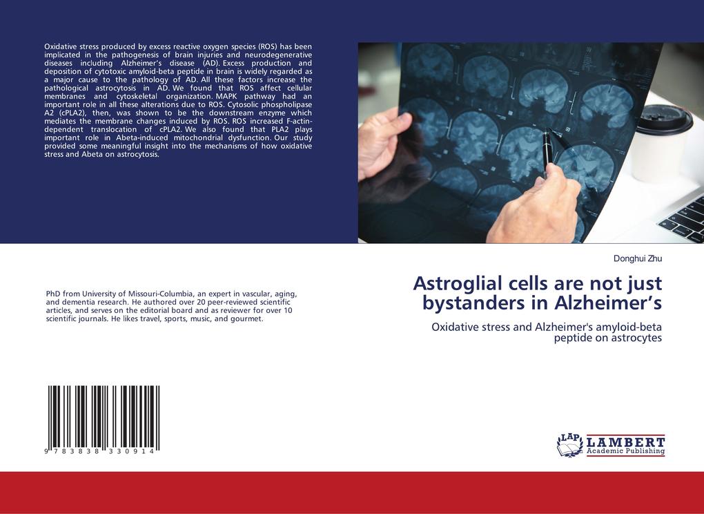 Astroglial cells are not just bystanders in Alzheimer's