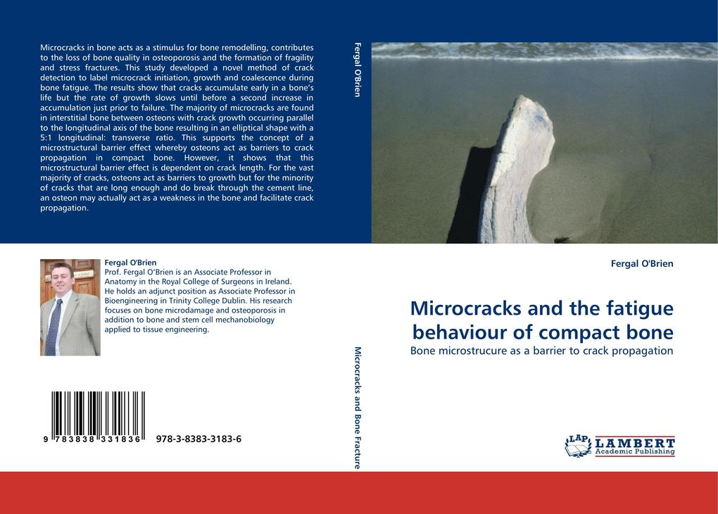 Microcracks and the fatigue behaviour of compact bone
